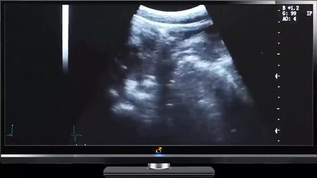 Daddy Ultrasound Deep Fuck